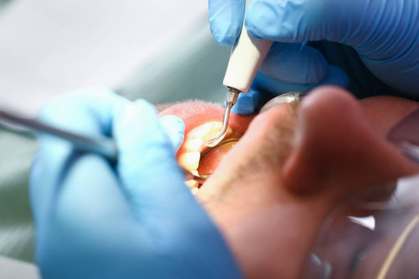 Best Emergency Treatment for Toothache in Griggsvle, IL