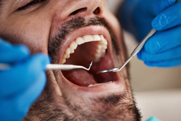  Griggsvle, IL Emergency Dentist Pros